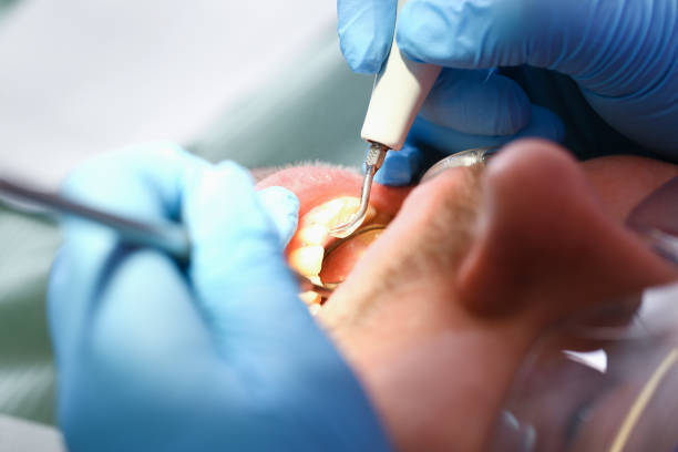 Best Emergency Cosmetic Dentistry in Grandview, OK
