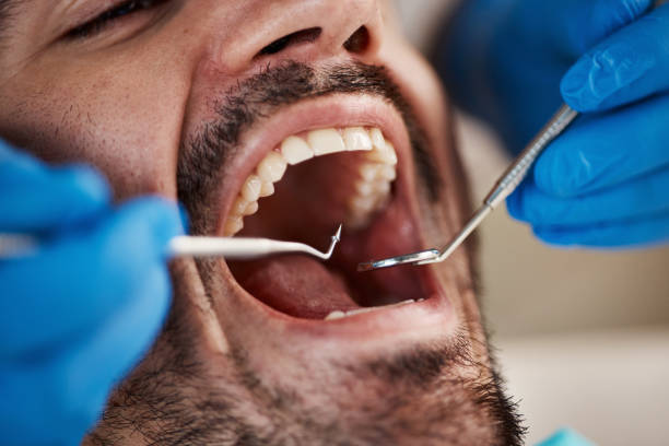 Best Emergency Dental Extractions in Grandview, OK