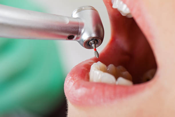 Best Urgent Dental Care for Toothache in Grandview, OK